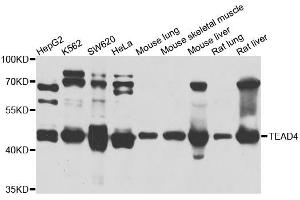 Western blot analysis of extracts of various cell lines, using TEAD4 antibody. (TEAD4 Antikörper)