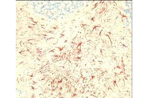 Immunohistochemical staining on mouse brain sections using C5aR antibody ABIN113333. (C5AR1 Antikörper  (C-Term))