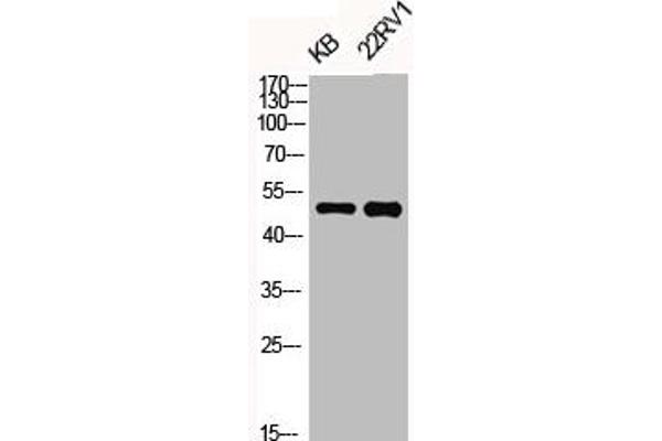 OPRK1 Antikörper  (pSer369)