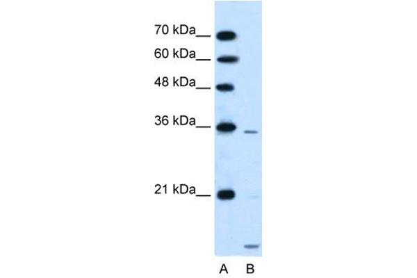 SLC25A39 Antikörper  (C-Term)