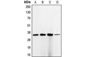 Western blot analysis of CDC2 expression in HeLa (A), K562 (B), MCF7 (C), A431 (D) whole cell lysates. (CDK1 Antikörper  (Center))