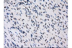 Immunohistochemical staining of paraffin-embedded colon tissue using anti-ID3mouse monoclonal antibody. (ID3 Antikörper)