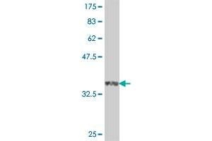 Western Blot detection against Immunogen (37. (PDE7A Antikörper  (AA 18-117))