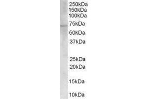 Western Blotting (WB) image for Choline O-Acetyltransferase (CHAT) peptide (ABIN369257) (Choline O-Acetyltransferase (CHAT) Peptid)