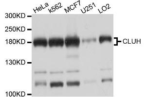 Western blot analysis of extracts of various cell lines, using CLUH antibody (ABIN4903318) at 1:1000 dilution. (CLUH Antikörper)