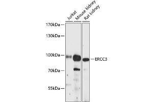 Western blot analysis of extracts of various cell lines, using ERCC3 antibody (ABIN6127770, ABIN6140267, ABIN6140268 and ABIN6216436) at 1:3000 dilution. (ERCC3 Antikörper  (AA 512-782))