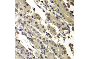 Immunohistochemistry of paraffin-embedded human stomach using SUB1 antibody (ABIN5974252) at dilution of 1/100 (40x lens). (SUB1 Antikörper)