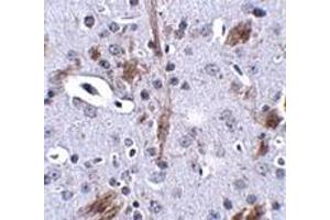 Immunohistochemistry (IHC) image for anti-tau Tubulin Kinase 1 (Ttbk1) (C-Term) antibody (ABIN1030783) (TTBK1 Antikörper  (C-Term))