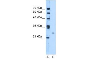 TMEM126B antibody used at 1. (TMEM126B Antikörper  (Middle Region))