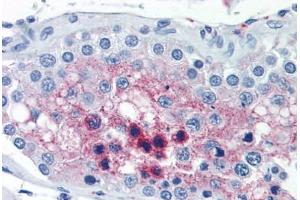 Human Testis (formalin-fixed, paraffin-embedded) stained with CTSL2 antibody ABIN351497 at 10 ug/ml followed by biotinylated anti-mouse IgG secondary antibody ABIN481714, alkaline phosphatase-streptavidin and chromogen. (Cathepsin L2 Antikörper)