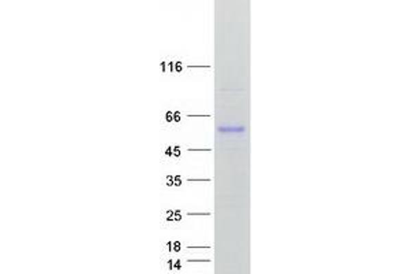 CYP51A1 Protein (Myc-DYKDDDDK Tag)