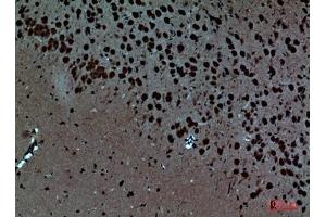 Immunohistochemical analysis of paraffin-embedded Mouse-brain, antibody was diluted at 1:100. (Pleiotrophin Antikörper  (Internal Region))