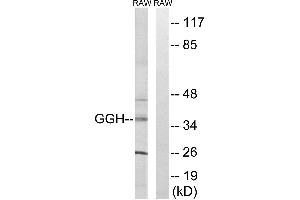 Western blot analysis of extracts from RAW264. (GGH Antikörper  (Internal Region))