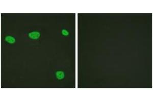 Immunofluorescence analysis of HeLa cells, using Vitamin D Receptor (Ab-208) Antibody. (Vitamin D Receptor Antikörper  (AA 181-230))