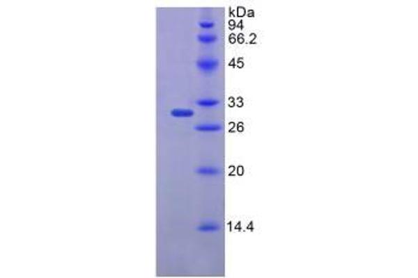 FKBP10 Protein