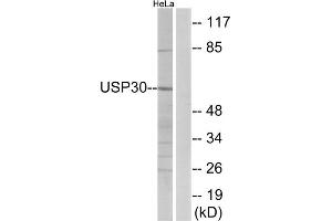 Western blot analysis of extracts from HeLa cells, using USP30 antibody. (Usp30 Antikörper  (N-Term))