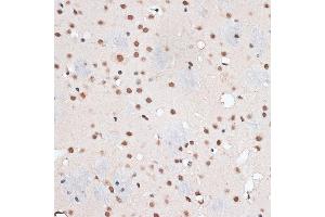 Immunohistochemistry of paraffin-embedded mouse brain using RBM3 antibody  at dilution of 1:100 (40x lens). (RBM3 Antikörper  (AA 1-157))