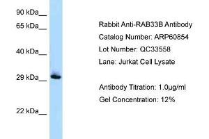 Western Blotting (WB) image for anti-RAB33B, Member RAS Oncogene Family (RAB33B) (Middle Region) antibody (ABIN2788609) (RAB33B Antikörper  (Middle Region))