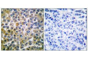 Immunohistochemistry (IHC) image for anti-SMAD, Mothers Against DPP Homolog 1 (SMAD1) (Ser465) antibody (ABIN1847896) (SMAD1 Antikörper  (Ser465))