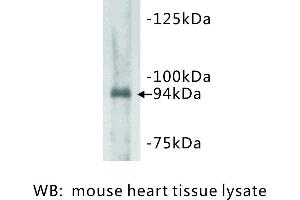 Image no. 1 for anti-Junctophilin 2 (JPH2) antibody (ABIN1112815) (Junctophilin 2 Antikörper)