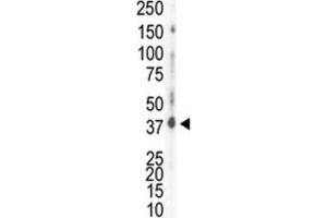 Western Blotting (WB) image for anti-Casein Kinase 1, delta (CSNK1D) antibody (ABIN3003190) (Casein Kinase 1 delta Antikörper)