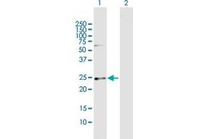 Western Blot analysis of CSN1S1 expression in transfected 293T cell line by CSN1S1 MaxPab polyclonal antibody. (Casein alpha S1 Antikörper  (AA 1-185))