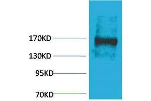 Western Blotting (WB) image for anti-Ectopic P-Granules Autophagy Protein 5 Homolog (EPG5) antibody (ABIN3181524) (EPG5 Antikörper)