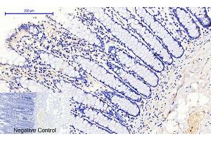 Immunohistochemical analysis of paraffin-embedded human colon tissue. (JAK1 Antikörper  (pTyr1022))