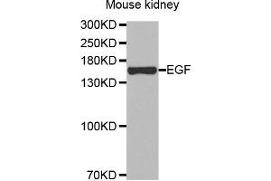 Western Blotting (WB) image for anti-Epidermal Growth Factor (EGF) antibody (ABIN6219771) (EGF Antikörper)