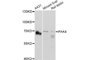 Western blot analysis of extracts of various cell lines, using PAK4 Antibody (ABIN5971470) at 1:3000 dilution. (PAK4 Antikörper)