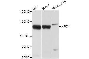 Western blot analysis of extracts of various cell lines, using XPO1 antibody (ABIN5970125) at 1/1000 dilution. (XPO1 Antikörper)