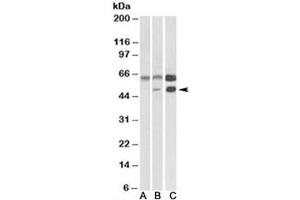 Western blot testing of human cerebellum [A], mouse brain [B], and rat brain [C] lysates with CAMK2A antibody at 0. (CAMK2A Antikörper)