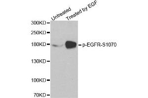 Western Blotting (WB) image for anti-Epidermal Growth Factor Receptor (EGFR) (pSer1070) antibody (ABIN1870119) (EGFR Antikörper  (pSer1070))