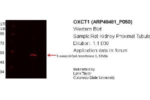 Western Blotting (WB) image for anti-3-Oxoacid CoA Transferase 1 (OXCT1) (Middle Region) antibody (ABIN311042) (OXCT1 Antikörper  (Middle Region))
