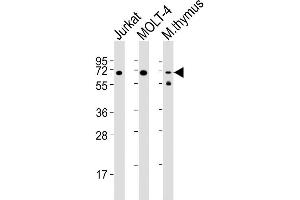 Lane 1: Jurkat Cell lysates, Lane 2: MOLT-4 Cell lysates, Lane 3: mouse thymus Cell lysates, probed with Zap70 (1484CT290. (ZAP70 Antikörper)