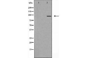 Western blot analysis of extracts from COS7 cells, using AAK1 antibody. (AAK1 Antikörper  (Internal Region))