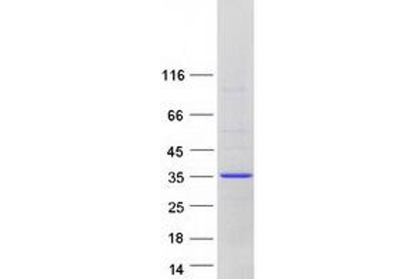 GS28 Protein (Transcript Variant 3) (Myc-DYKDDDDK Tag)