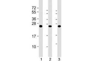 Western blot testing of human 1) A431, 2) HL-60 and 3) U2OS cell lysate with RAB5C antibody at 1:2000. (Rab5c Antikörper)