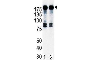 Western blot analysis of ErbB2 in T47D cell lysate, either noninduced (Lane 1) or induced with HRG (2). (ErbB2/Her2 Antikörper  (AA 21-52))