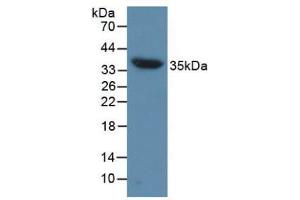 Figure. (Aquaporin 4 Antikörper  (AA 177-304))