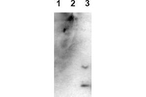 Western Blotting (WB) image for anti-Amyloid beta (Abeta) (AA 1-43), (C-Term), (N-Term) antibody (ABIN126727) (beta Amyloid Antikörper  (C-Term, N-Term))