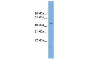 Image no. 1 for anti-Arrestin, beta 1 (ARRB1) (C-Term) antibody (ABIN6744484) (beta Arrestin 1 Antikörper  (C-Term))