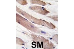 Formalin-fixed and paraffin-embedded human skeletal muscle tissue reacted with PIK3R1-p, which was peroxidase-conjugated to the secondary antibody, followed by DAB staining. (PIK3R1 Antikörper  (AA 558-587))