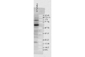 Western Blotting (WB) image for anti-Heat Shock 70kDa Protein 1A (HSPA1A) antibody (ABIN6657343)