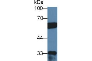 Western Blot; Sample: Human Hela cell lysate; Primary Ab: 2µg/ml Rabbit Anti-Human PTBP1 Antibody Second Ab: 0. (PTBP1 Antikörper  (AA 1-531))