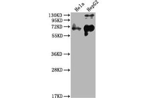 Western Blot Positive WB detected in: Hela whole cell lysate, HepG2 whole cell lysate All lanes: YAP1 antibody at 1:2000 Secondary Goat polyclonal to rabbit IgG at 1/50000 dilution Predicted band size: 55, 53, 49, 37, 49, 50, 51, 54 kDa Observed band size: 65 kDa (YAP1 Antikörper  (AA 155-504))