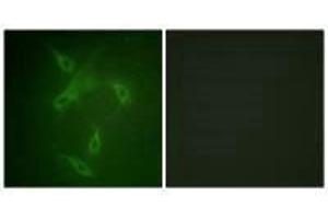 Immunofluorescence analysis of NIH/3T3 cells, using JAK2 (Ab-570) antibody. (JAK2 Antikörper  (Tyr570))