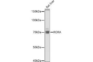 Western blot analysis of extracts of Rat liver, using RORA antibody (ABIN6130662, ABIN6147077, ABIN6147078 and ABIN6222727) at 1:1000 dilution. (RORA Antikörper  (AA 169-468))