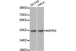 Western blot analysis of extracts of various cell lines, using MAPK3 antibody (ABIN5970057) at 1/1000 dilution. (ERK1 Antikörper  (N-Term))