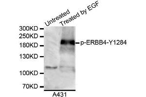 Western blot analysis of extracts of A431 cell line, using Phospho-ERBB4-Y1284 antibody. (ERBB4 Antikörper  (pTyr1284))